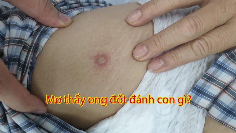 Mơ thấy ong đốt đánh con gì?