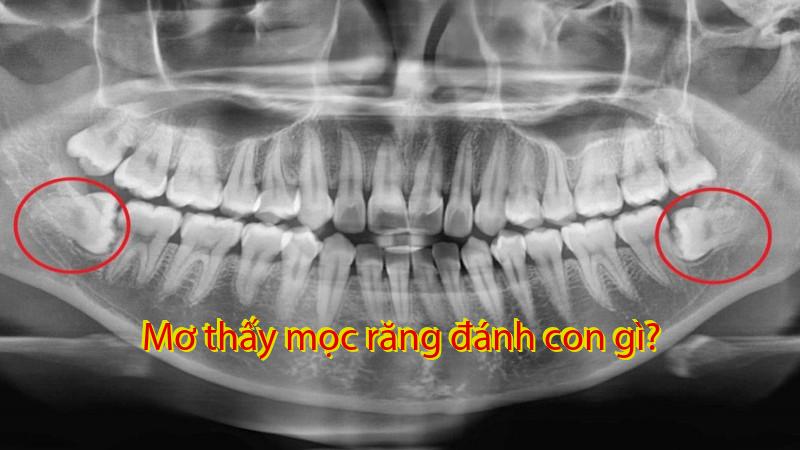 Mơ thấy mọc răng đánh con gì?