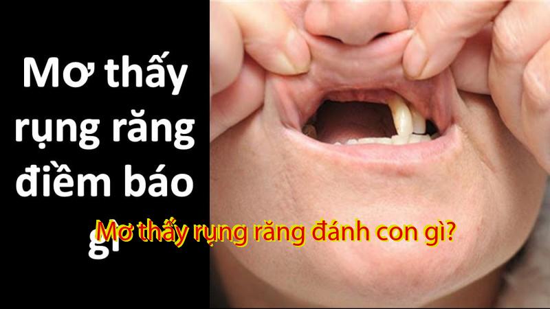 Mơ thấy rụng răng đánh con gì?