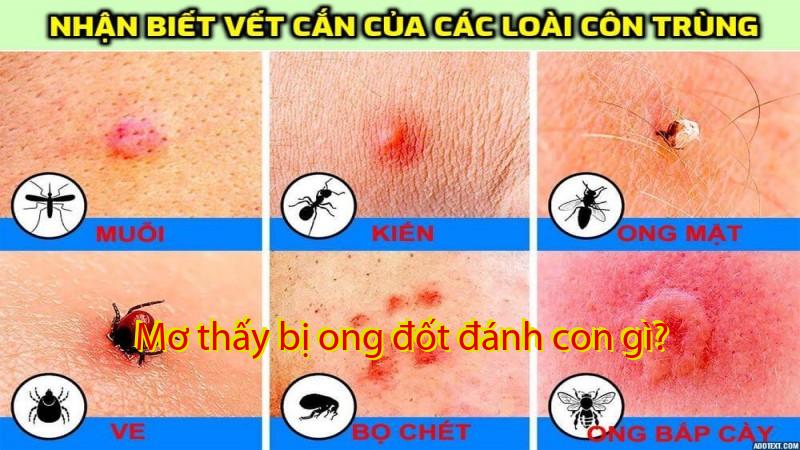 Mơ thấy bị ong đốt đánh con gì?